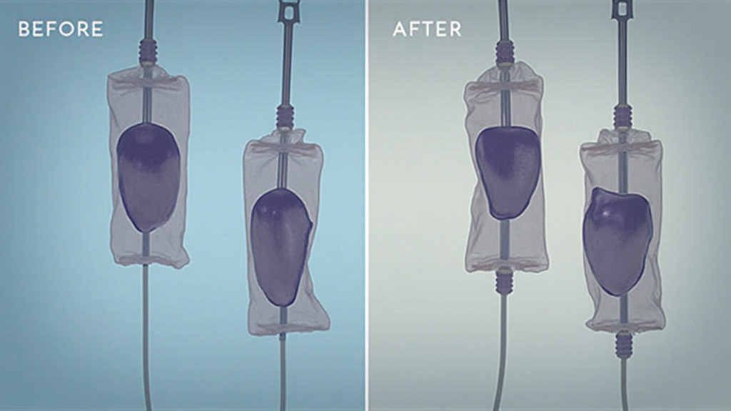 IV Therapies Tailored for Men